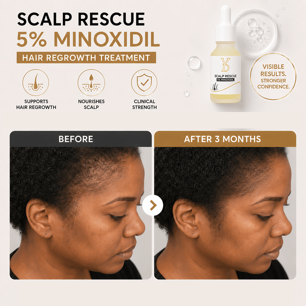 YD Scalp Rescue - Before and After 3 Months Results