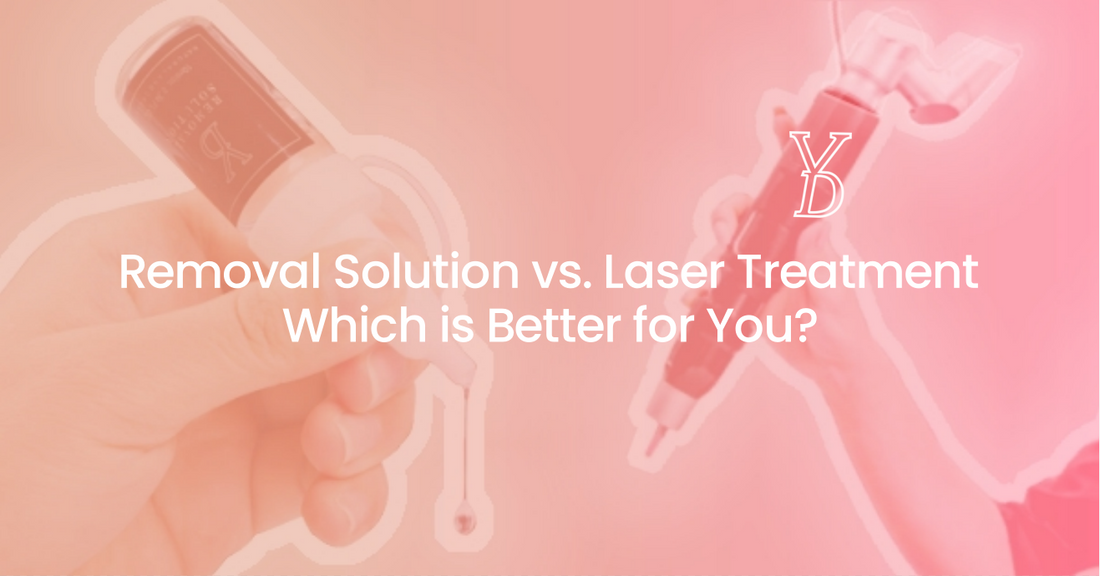 Tattoo Removal Solution vs. Laser Treatment, which is better for you?