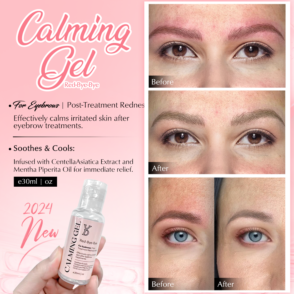 YD Calming Gel (Red-Bye-Bye)