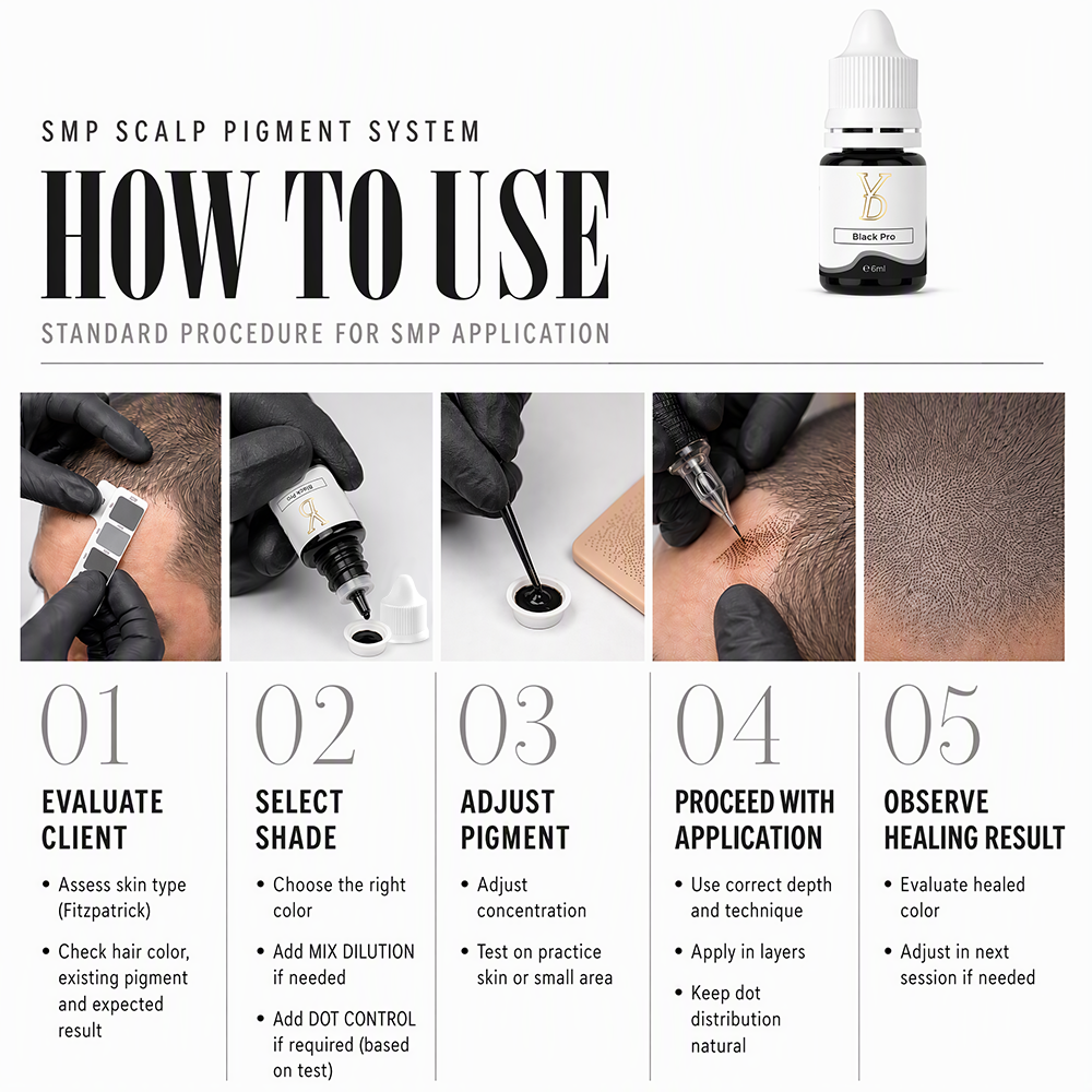 YDPMU SMP Scalp Pigment System – 5 Colors + 2 Solutions