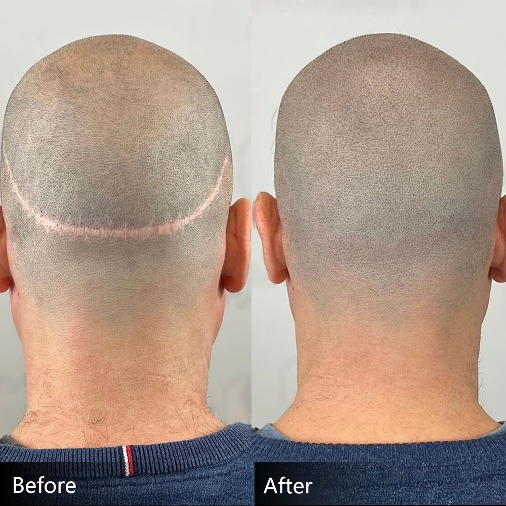 YDPMU Professional SMP Pigments 15ml — 7 Formulas | CI77266 Carbon Black | Scalp Micropigmentation