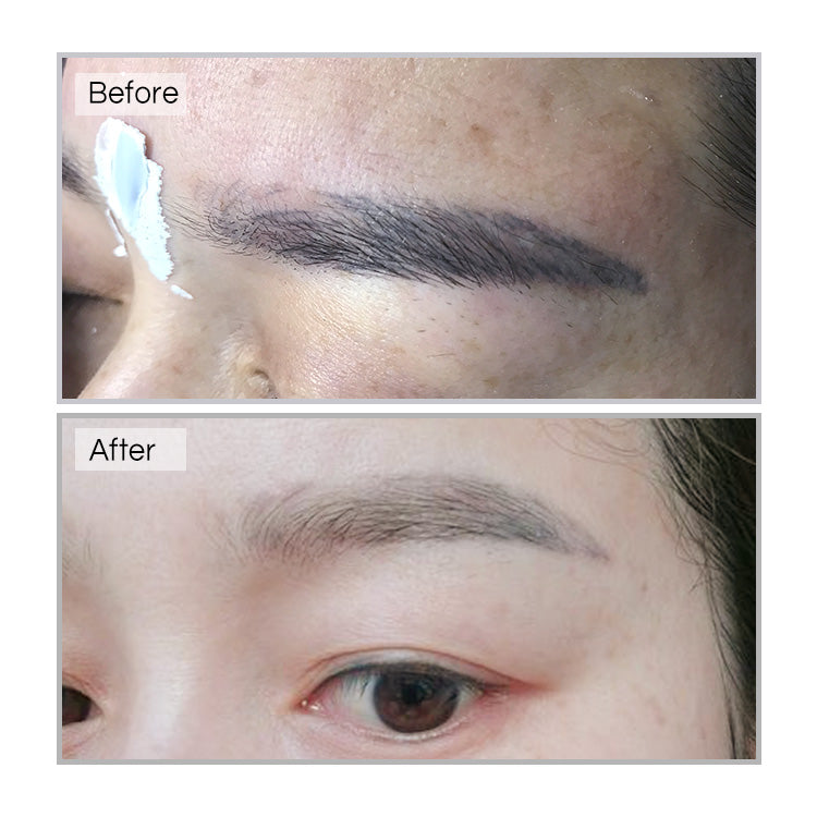 Eyebrows Comaprison of before and after using YD Tattoo Remover